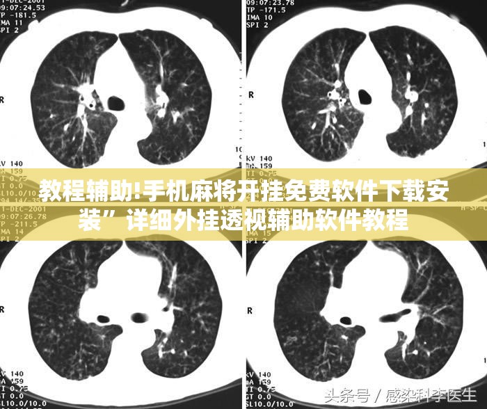 教程辅助!手机麻将开挂免费软件下载安装”详细外挂透视辅助软件教程