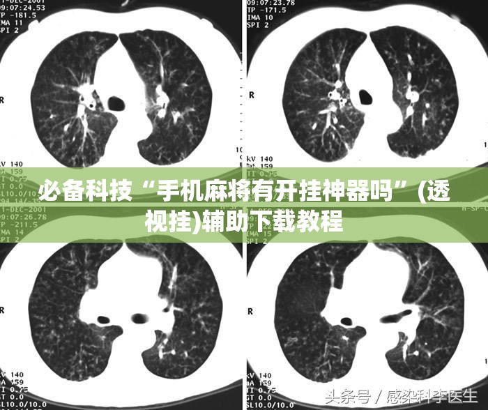 必备科技“手机麻将有开挂神器吗”(透视挂)辅助下载教程