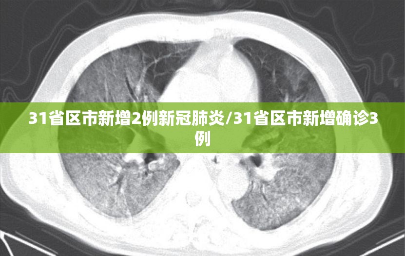 31省区市新增2例新冠肺炎/31省区市新增确诊3例