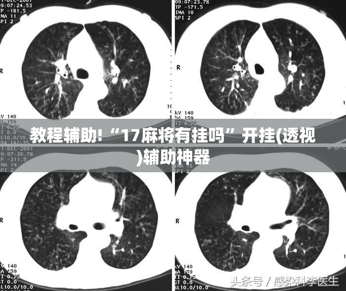 教程辅助!“17麻将有挂吗”开挂(透视)辅助神器