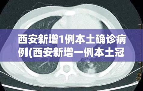 西安新增1例本土确诊病例(西安新增一例本土冠状病毒肺炎) 西安新增1例本土确诊病例(西安新增一例本土冠状病毒肺炎)