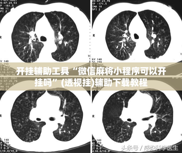 开挂辅助工具“微信麻将小程序可以开挂吗”(透视挂)辅助下载教程
