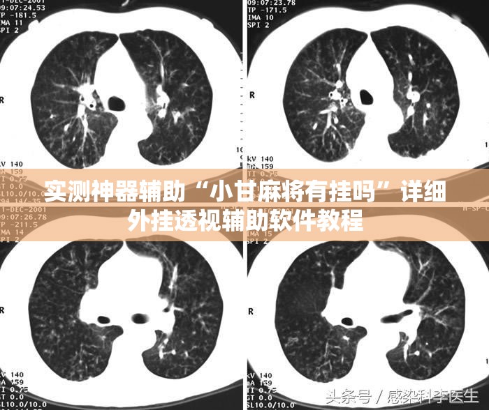 实测神器辅助“小甘麻将有挂吗”详细外挂透视辅助软件教程