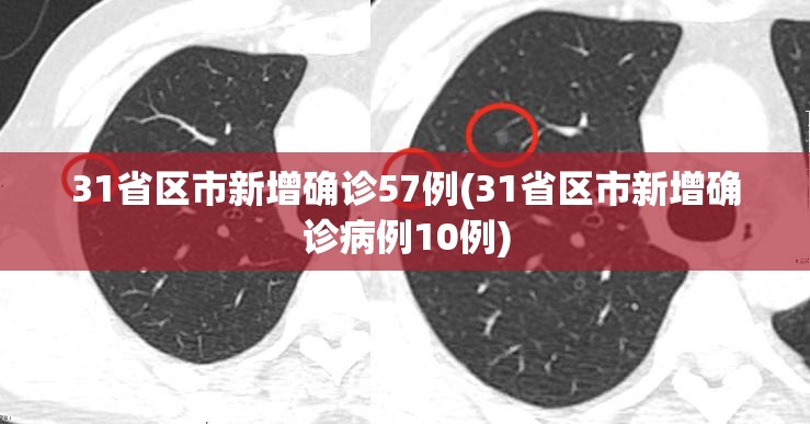 31省区市新增确诊57例(31省区市新增确诊病例10例) 31省区市新增确诊57例(31省区市新增确诊病例10例)