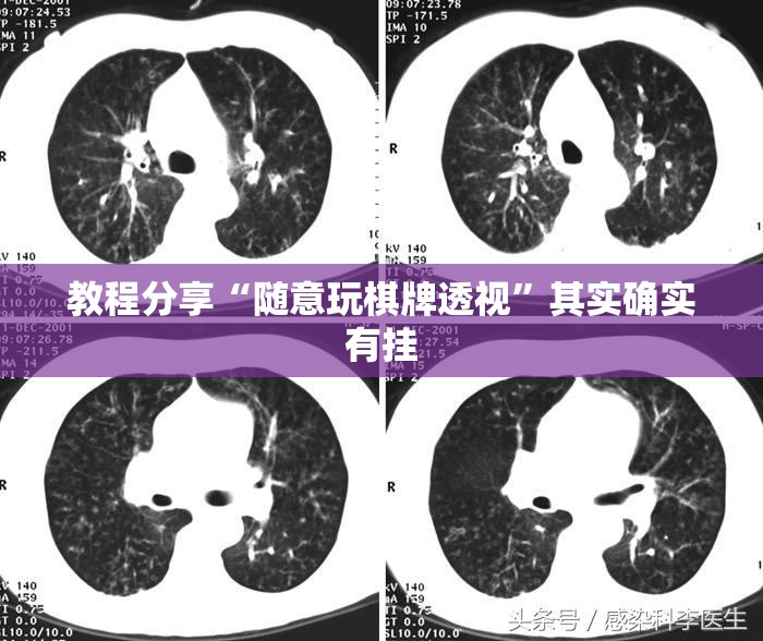 教程分享“随意玩棋牌透视”其实确实有挂