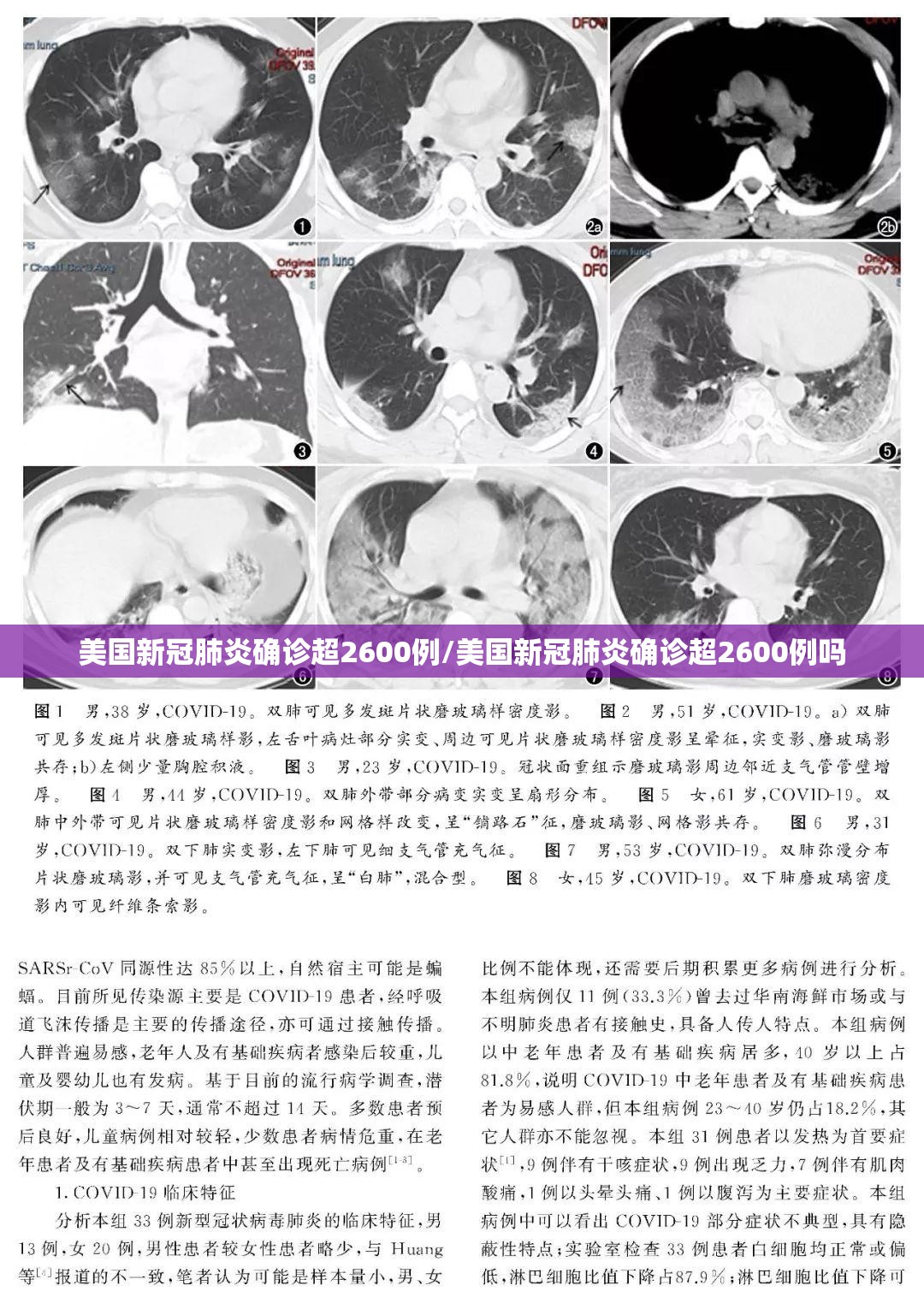 美国新冠肺炎确诊超2600例/美国新冠肺炎确诊超2600例吗 美国新冠肺炎确诊超2600例/美国新冠肺炎确诊超2600例吗