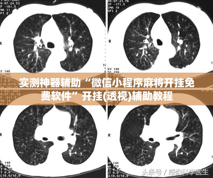 实测神器辅助“微信小程序麻将开挂免费软件”开挂(透视)辅助教程