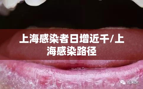 上海感染者日增近千/上海感染路径
