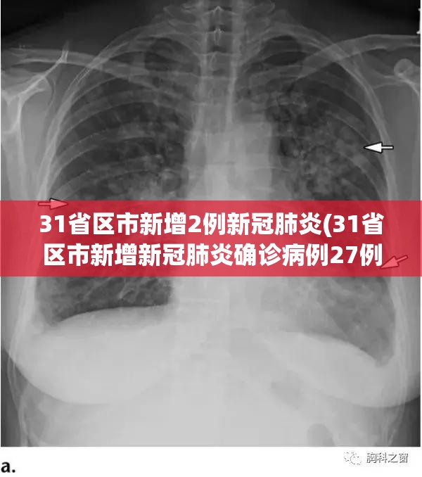 31省区市新增2例新冠肺炎(31省区市新增新冠肺炎确诊病例27例) 31省区市新增2例新冠肺炎(31省区市新增新冠肺炎确诊病例27例)