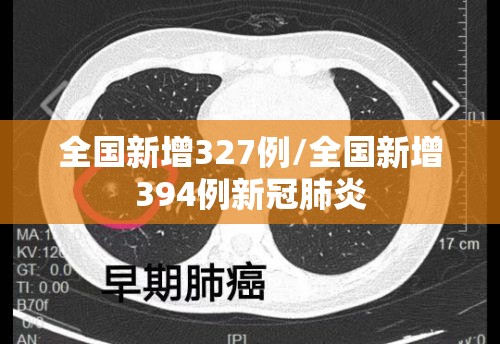 全国新增327例/全国新增394例新冠肺炎 全国新增327例/全国新增394例新冠肺炎