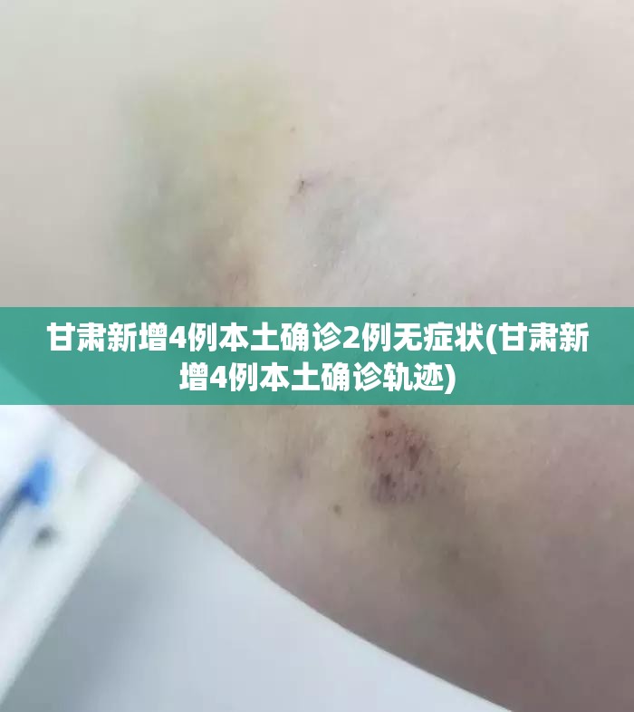 甘肃新增4例本土确诊2例无症状(甘肃新增4例本土确诊轨迹) 甘肃新增4例本土确诊2例无症状(甘肃新增4例本土确诊轨迹)