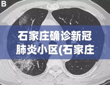 石家庄确诊新冠肺炎小区(石家庄已确诊小区) 石家庄确诊新冠肺炎小区(石家庄已确诊小区)
