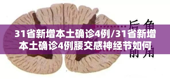 31省新增本土确诊4例/31省新增本土确诊4例腰交感神经节如何定位 31省新增本土确诊4例/31省新增本土确诊4例腰交感神经节如何定位