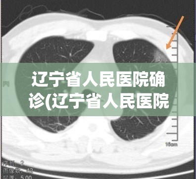 辽宁省人民医院确诊(辽宁省人民医院确诊新冠肺炎) 辽宁省人民医院确诊(辽宁省人民医院确诊新冠肺炎)