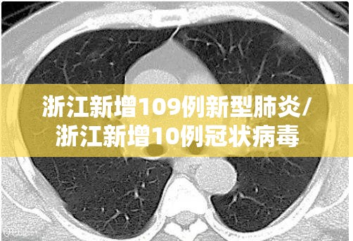 浙江新增109例新型肺炎/浙江新增10例冠状病毒 浙江新增109例新型肺炎/浙江新增10例冠状病毒