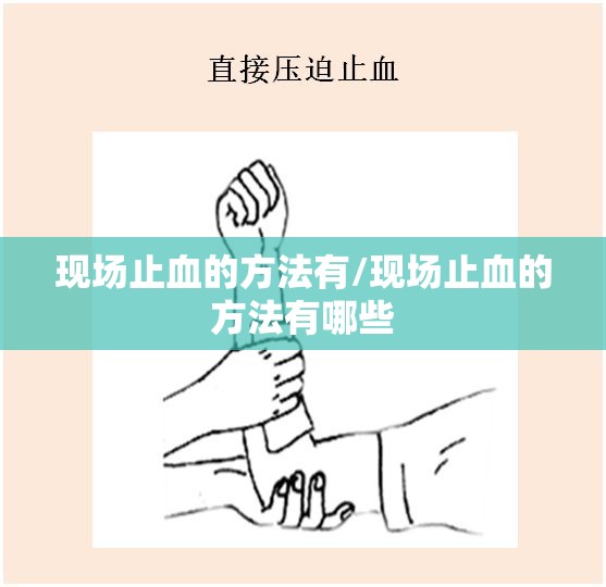 现场止血的方法有/现场止血的方法有哪些 现场止血的方法有/现场止血的方法有哪些