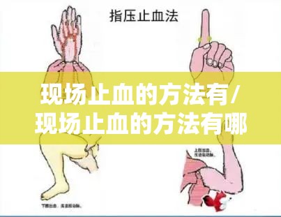 现场止血的方法有/现场止血的方法有哪些 现场止血的方法有/现场止血的方法有哪些