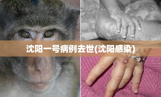 沈阳一号病例去世(沈阳感染) 沈阳一号病例去世(沈阳感染)