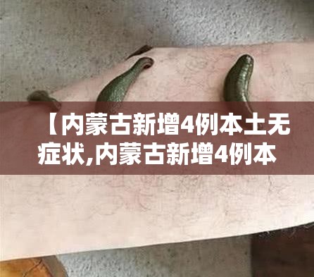 【内蒙古新增4例本土无症状,内蒙古新增4例本土无症状病例】 【内蒙古新增4例本土无症状,内蒙古新增4例本土无症状病例】
