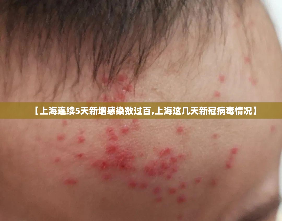 【上海连续5天新增感染数过百,上海这几天新冠病毒情况】 【上海连续5天新增感染数过百,上海这几天新冠病毒情况】