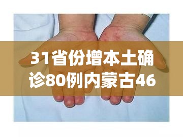 31省份增本土确诊80例内蒙古46例(内蒙古病毒疫情)