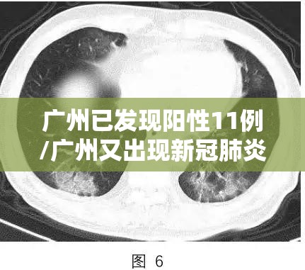 广州已发现阳性11例/广州又出现新冠肺炎