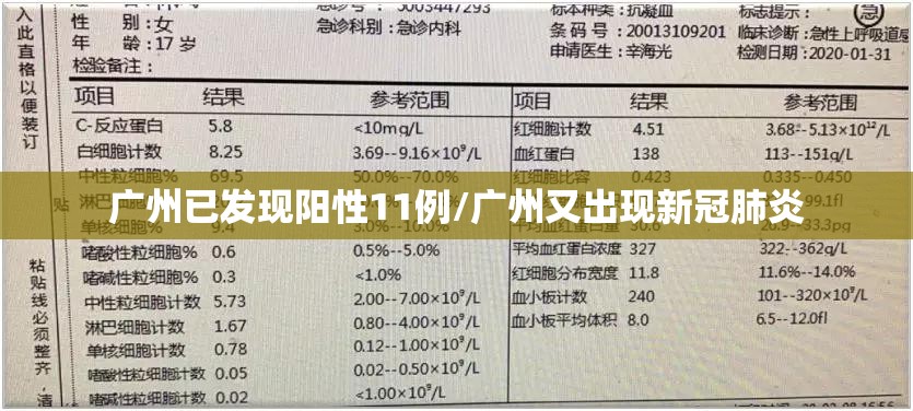 广州已发现阳性11例/广州又出现新冠肺炎 广州已发现阳性11例/广州又出现新冠肺炎