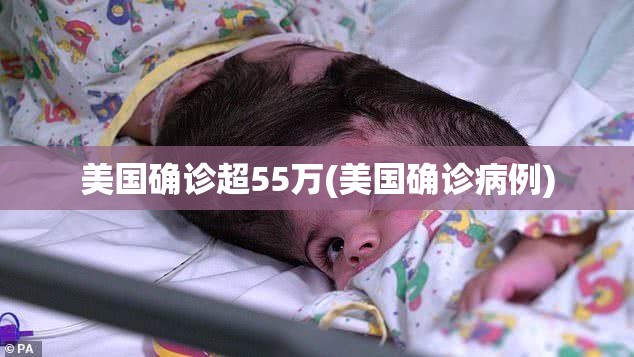 美国确诊超55万(美国确诊病例)