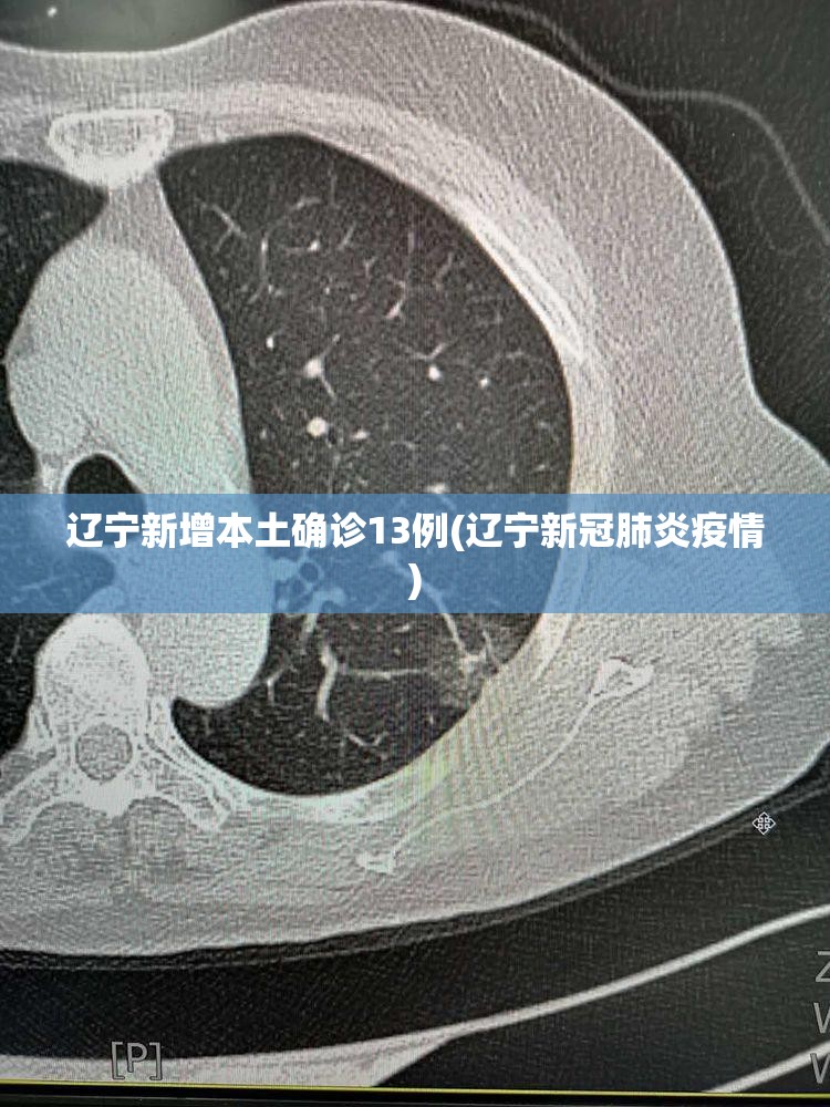 辽宁新增本土确诊13例(辽宁新冠肺炎疫情)