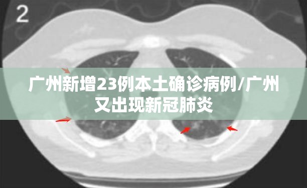 广州新增23例本土确诊病例/广州又出现新冠肺炎