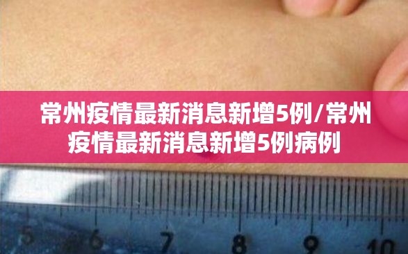 常州疫情最新消息新增5例/常州疫情最新消息新增5例病例