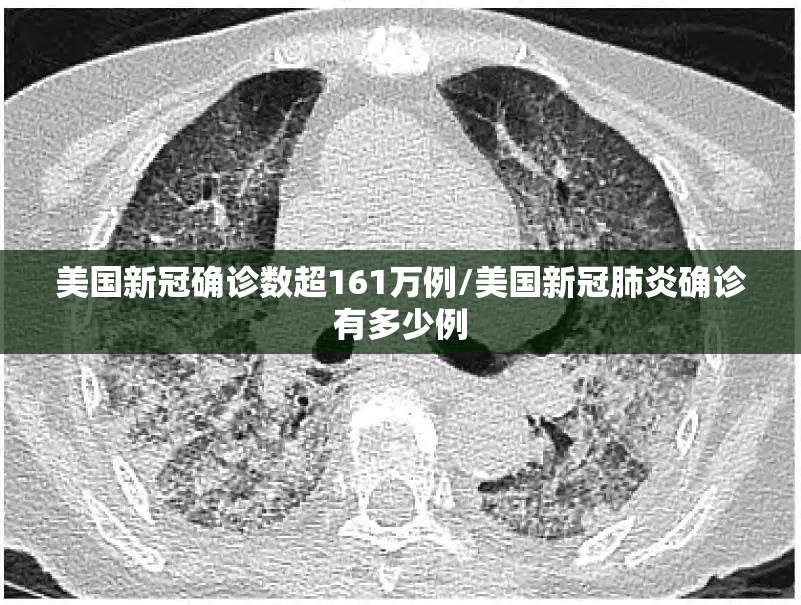 美国新冠确诊数超161万例/美国新冠肺炎确诊有多少例