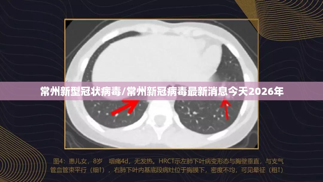常州新型冠状病毒/常州新冠病毒最新消息今天2026年 常州新型冠状病毒/常州新冠病毒最新消息今天2026年