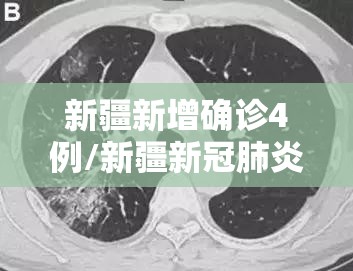 新疆新增确诊4例/新疆新冠肺炎确诊病例 新疆新增确诊4例/新疆新冠肺炎确诊病例