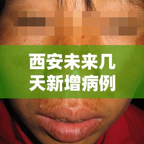 西安未来几天新增病例仍可能较多/脸上长黄褐斑看什么科 西安未来几天新增病例仍可能较多/脸上长黄褐斑看什么科