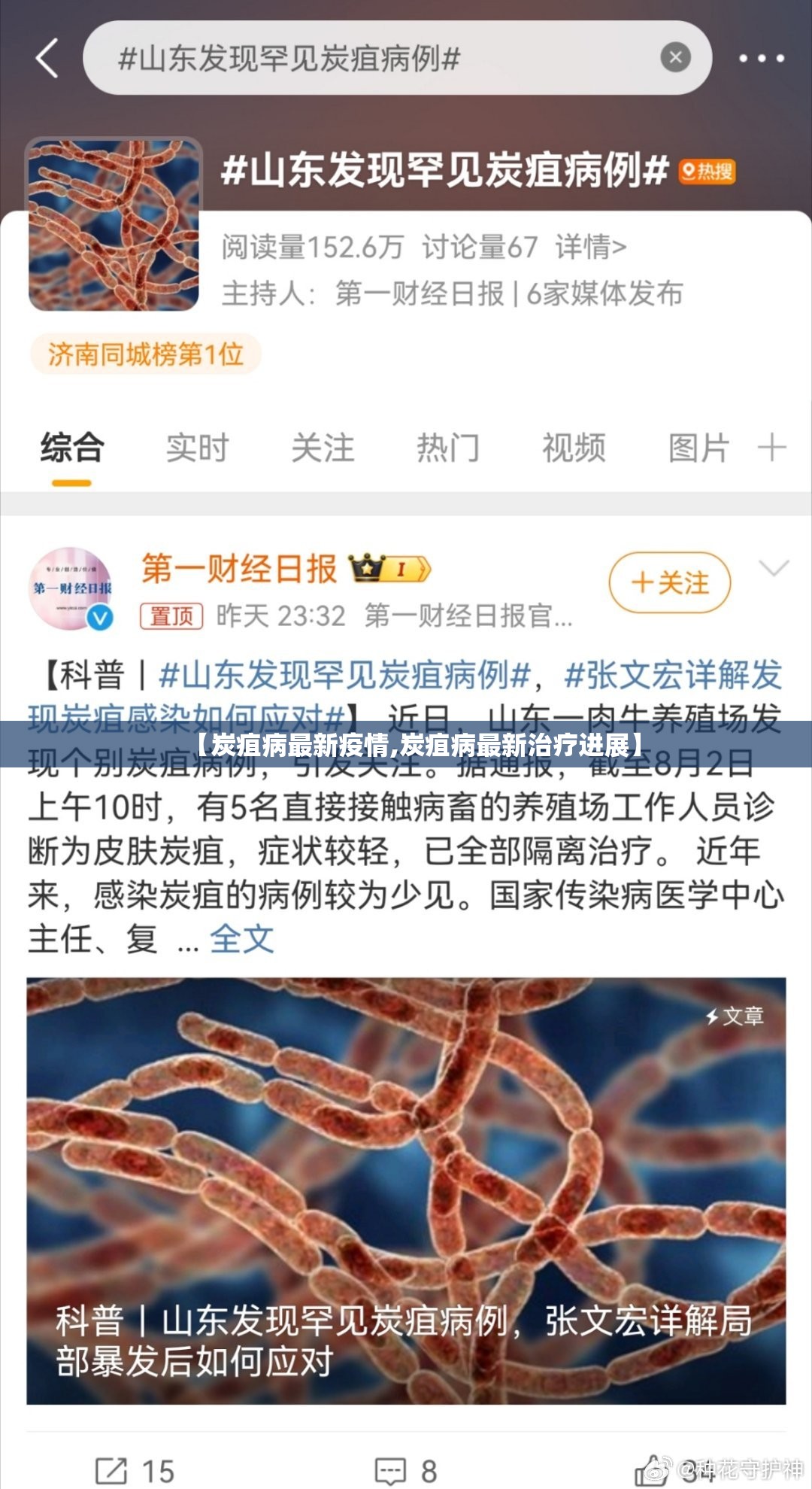 【炭疽病最新疫情,炭疽病最新治疗进展】 【炭疽病最新疫情,炭疽病最新治疗进展】