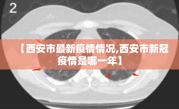 【西安市最新疫情情况,西安市新冠疫情是哪一年】 【西安市最新疫情情况,西安市新冠疫情是哪一年】